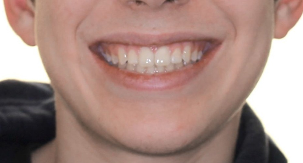 Original Image