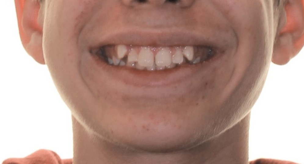Modified Image