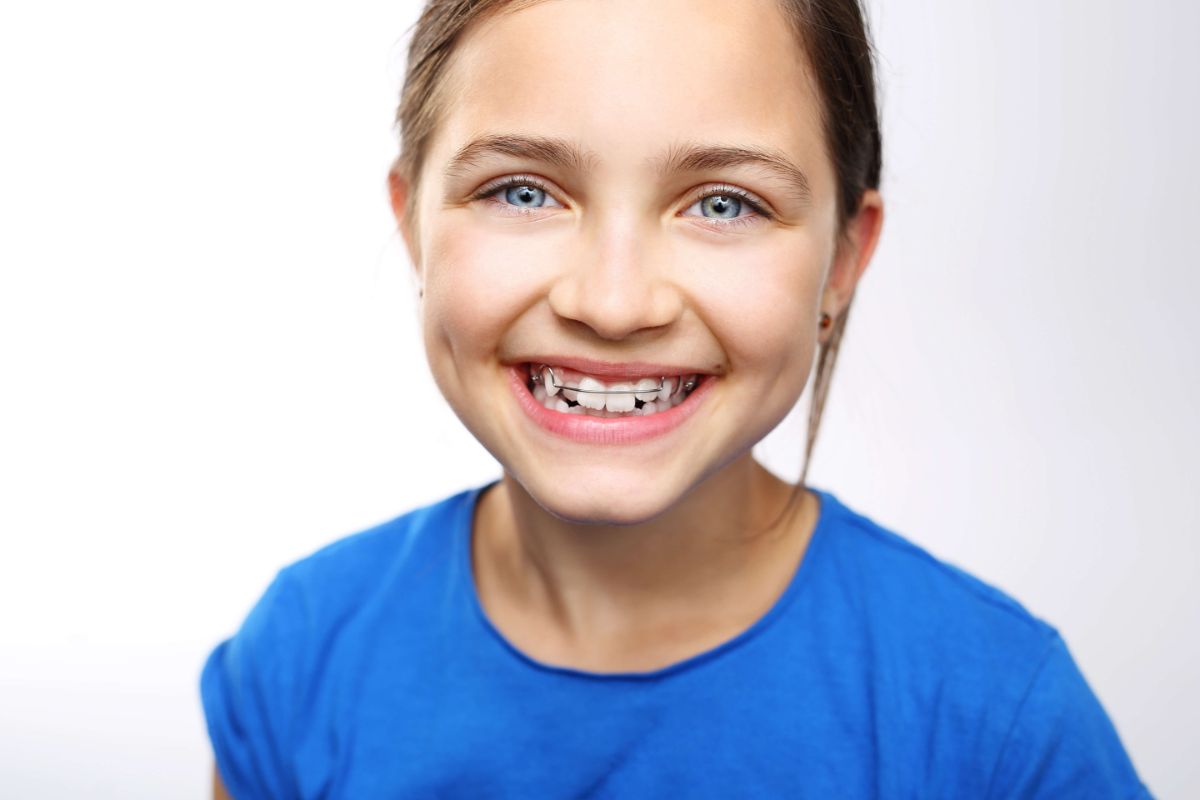 Everything You Need to Know About Palatal Expanders