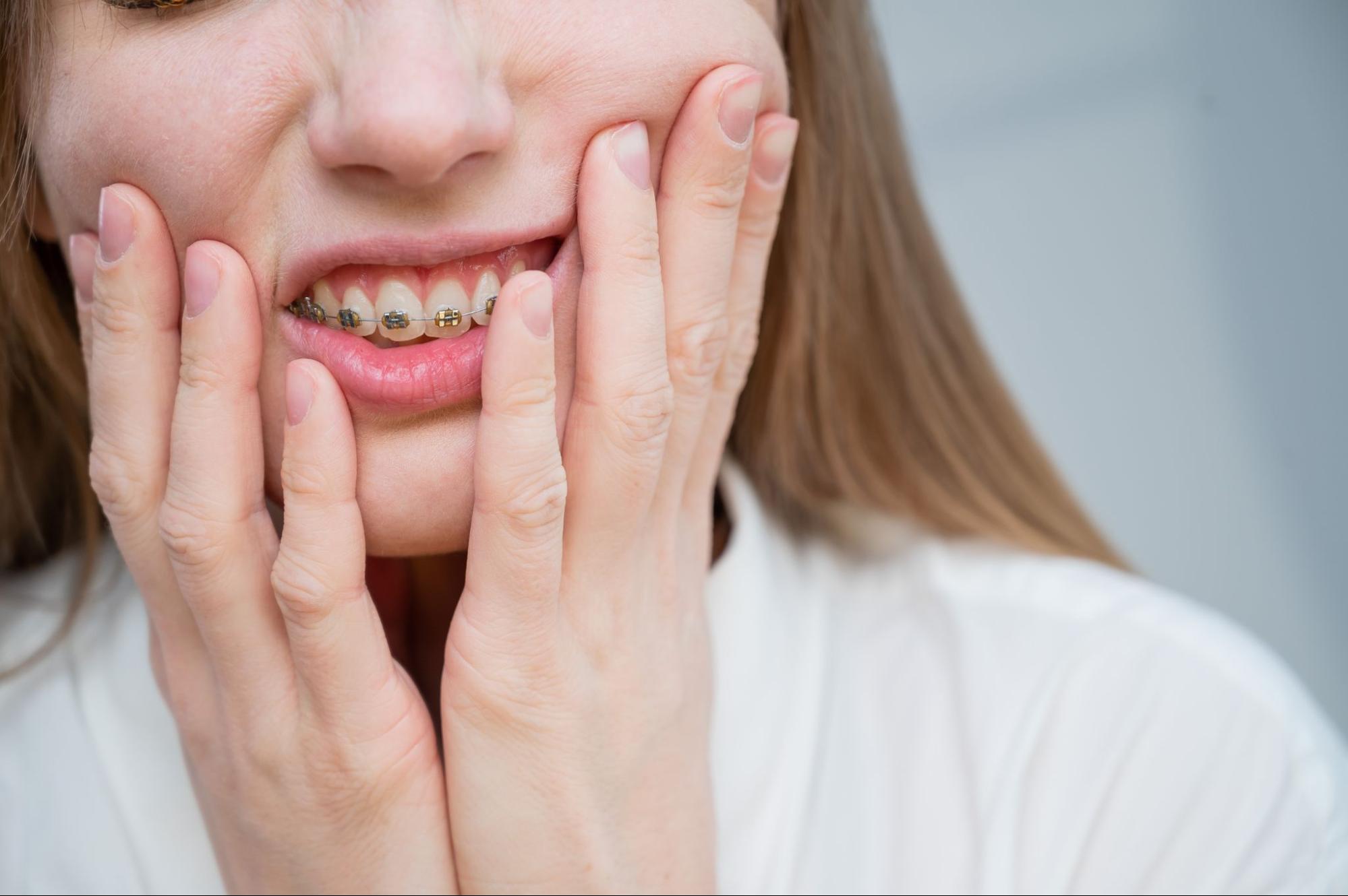 How to Manage Discomfort with Braces