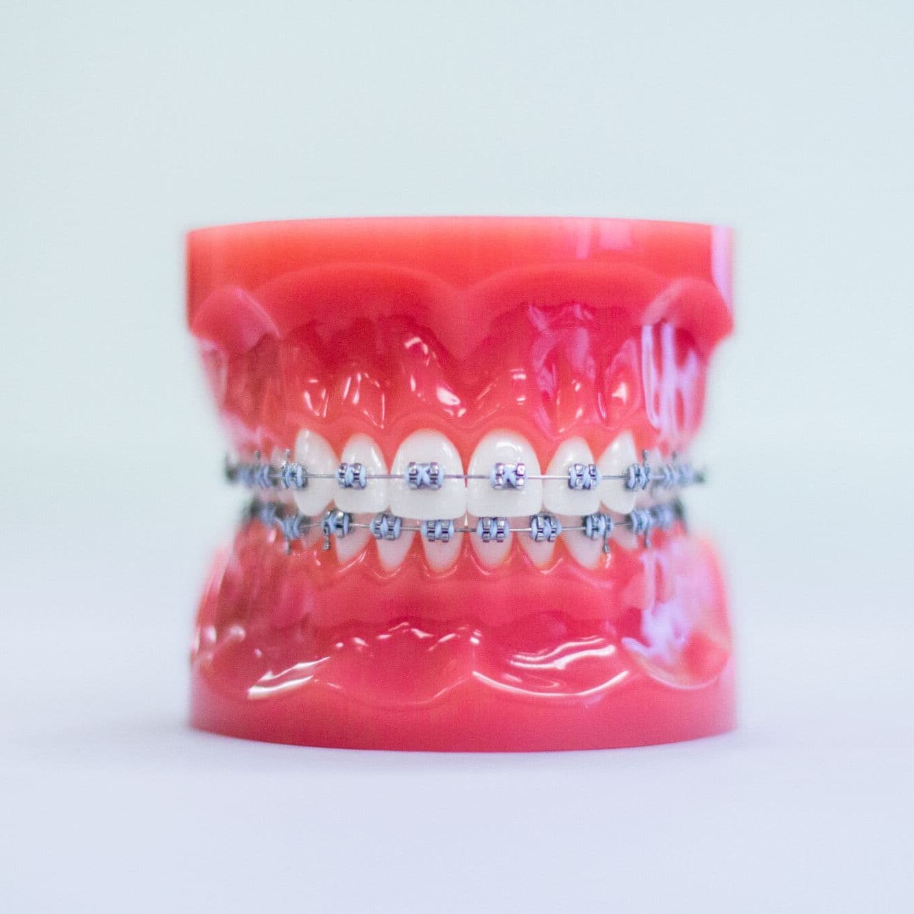 metal braces chandler az