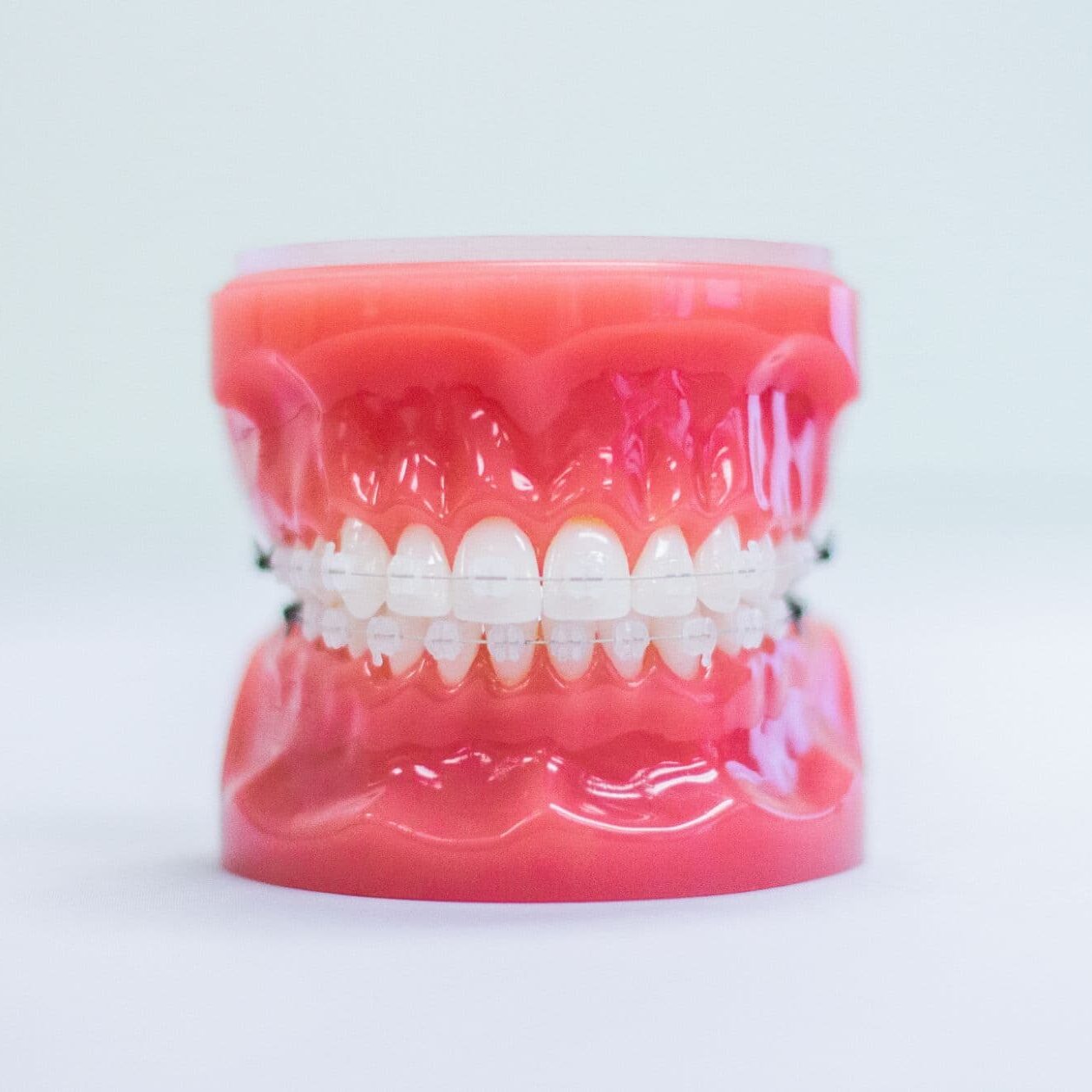 clear braces phoenix az